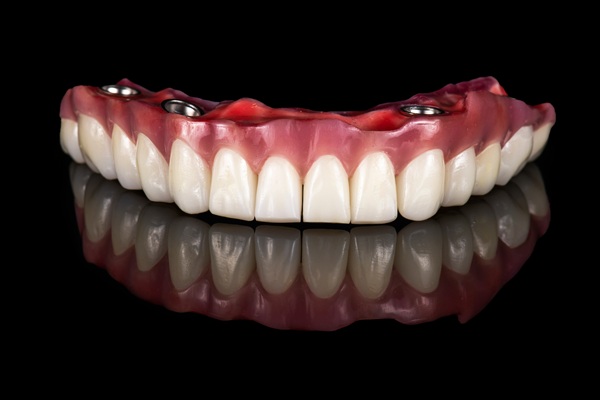 What Is The Difference Between All On   Implants And Regular Dental Implants?