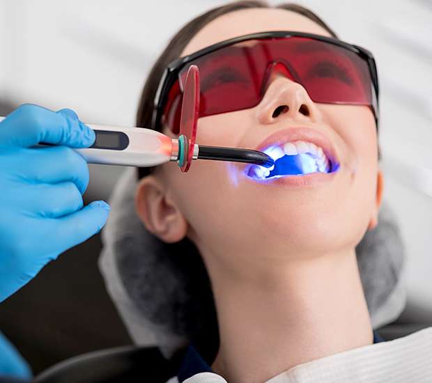 Santa Barbara Professional Teeth Whitening